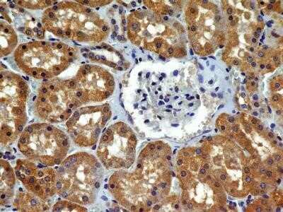 Immunohistochemistry-Paraffin: VEGFR2/KDR/Flk-1 Antibody (2C6) - Azide and BSA Free [NBP2-81009] - Analysis of FFPE tissue section of human normal kidney with antibody at 5 ug/ml concentration. The cuboidal epithelial cells of of various tubules/ducts showed a specific cytoplasmic immunopositivity of VEGF R2/KDR/Flk-1 protein. Image from the standard f