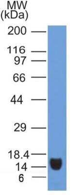 Western Blot: VEGFR2/KDR/Flk-1 Antibody (2C6) - Azide and BSA Free [NBP2-81009] - Analysis of VEGF R2/KDR/Flk-1 (clone 2C6) in partial recombinant protein. Image from the standard format of this antibody.