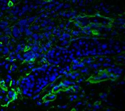 Immunohistochemistry-Frozen: VEGFR3/Flt-4 Antibody (AFL4) [Alexa Fluor® 488] [NBP1-43259AF488] - VEGFR-3 (green) was detected in murine cancer using VEGFR-3-AlexaFluor488 antibody (1:50; 1 hour) in PBS. Nuclei were stained with DAPI (blue). Tissue was fixed in acetone. Image from a verified customer review.