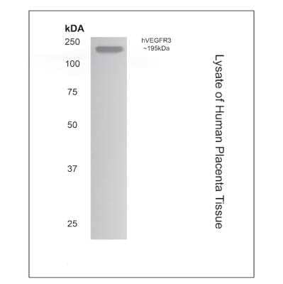 Western Blot: VEGFR3/Flt-4 Antibody (MM0003-7G63) - Azide and BSA Free [NB110-60968] - Lysate of human placenta tissue with Mouse Monoclonal anti-Human VEGFR3