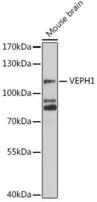 Western Blot: VEPH1 Antibody [NBP2-94141] - Analysis of extracts of Mouse brain, using VEPH1 .Exposure time: 5s.