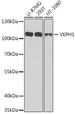 Western Blot: VEPH1 Antibody [NBP2-94141] - Analysis of extracts of various cell lines, using VEPH1 at 1:1000 dilution. Secondary antibody: HRP Goat Anti-Rabbit IgG (H+L) at 1:10000 dilution. Lysates/proteins: 25ug per lane. Blocking buffer: 3% nonfat dry milk in TBST. Detection: ECL Basic Kit . Exposure time: 30s.