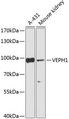 Western Blot: VEPH1 Antibody [NBP2-94600] - Analysis of extracts of various cell lines, using VEPH1 . Exposure time: 5s.