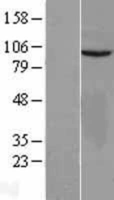 Western Blot: VEPH1 Overexpression Lysate (Adult Normal) [NBL1-17715] Left-Empty vector transfected control cell lysate (HEK293 cell lysate); Right -Over-expression Lysate for VEPH1.