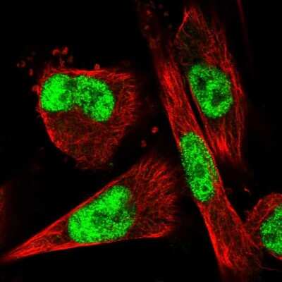 Immunocytochemistry/Immunofluorescence: VEZF1 Antibody [NBP1-84301] - Immunofluorescent staining of human cell line U-251 MG shows localization to nucleoplasm. Antibody staining is shown in green.