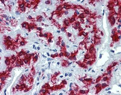 Immunohistochemistry: VEZF1 Antibody [NBP1-80115] - Analysis of human adrenal after heat-induced Antigen retrieval. Antibody concentration 5 ug/ml.