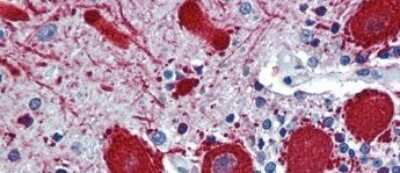 Immunohistochemistry-Paraffin: VEZF1 Antibody [NBP1-80115] - Human Brain tissue at an antibody concentration of 5.0ug/ml.