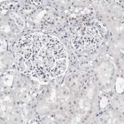 Immunohistochemistry-Paraffin: VEZF1 Antibody [NBP1-84301] - Staining of human kidney shows weak nuclear positivity in cells in tubules.