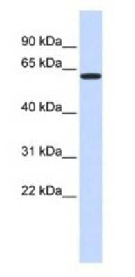 Western Blot: VEZF1 Antibody [NBP1-80115] - 293T Cell Lysate 1ug/ml Gel Concentration 12%