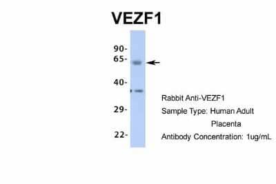 Western Blot: VEZF1 Antibody [NBP1-80115] - Human Adult Placenta, Antibody Dilution: 1.0 ug/ml.