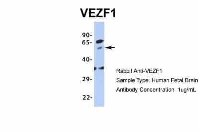 Western Blot: VEZF1 Antibody [NBP1-80115] - Human Fetal Brain, Antibody Dilution: 1.0 ug/ml.