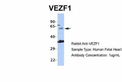 Western Blot: VEZF1 Antibody [NBP1-80115] - Human Fetal Heart, Antibody Dilution: 1.0 ug/ml.