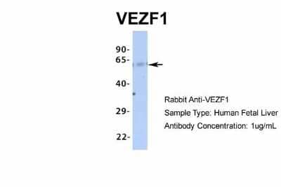 Western Blot: VEZF1 Antibody [NBP1-80115] - Human Fetal Liver, Antibody Dilution: 1.0 ug/ml.