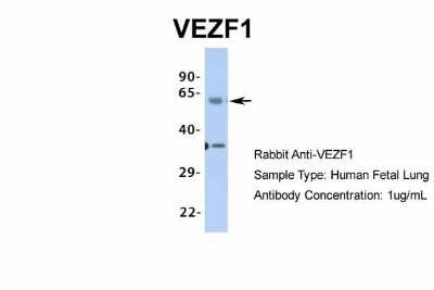 Western Blot: VEZF1 Antibody [NBP1-80115] - Human Fetal Lung, Antibody Dilution: 1.0 ug/ml.