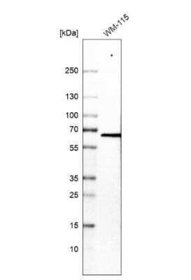 Western Blot: VEZF1 Antibody [NBP1-84301] - Analysis in human cell line WM-115.