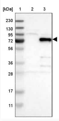 Western Blot: VEZT Antibody [NBP1-85039] - Lane 1: Marker [kDa] 230, 130, 95, 72, 56, 36, 28, 17, 11 Lane 2: Human cell line RT-4 Lane 3: Human cell line U-251MG sp