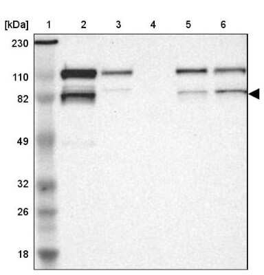 Western Blot: VEZT Antibody [NBP1-85040] - Lane 1: Marker [kDa] 230, 110, 82, 49, 32, 26, 18Lane 2: Human cell line RT-4Lane 3: Human cell line U-251MG spLane 4: Human plasma (IgG/HSA depleted)Lane 5: Human liver tissueLane 6: Human tonsil tissue