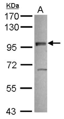 Western Blot VEZT Antibody