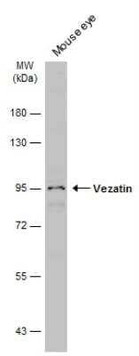 Western Blot VEZT Antibody