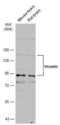 Western Blot VEZT Antibody