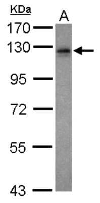 Western Blot: VEZT Antibody [NBP2-20856] - Sample (20 ug ) A: Hela cell membrance 7. 5% SDS PAGE gel, diluted at 1:1000.