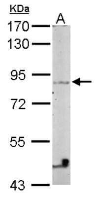 Western Blot: VEZT Antibody [NBP2-20856] - Sample (50 ug of whole cell lysate) A: Mouse Brain, 7. 5% SDS PAGE gel, diluted at 1:1000.