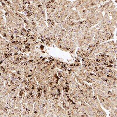 Immunohistochemistry-Paraffin: VG5Q Antibody [NB100-454] - VG5Q was detected in immersion fixed paraffin-embedded sections of human liver using Rabbit Anti-Human VG5Q polyclonal Antibody (Catalog # NB100-454) at 1:300 for 1 hour at room temperature followed by incubation with the Anti-Rabbit IgG VisUCyte&amp;#8482; HRP Polymer Antibody (Catalog # VC003). Tissue was stained using DAB (brown) and counterstained with hematoxylin (blue). Specific staining was localized to the cytoplasm in hepatocytes.