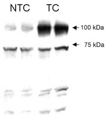 Western Blot: VG5Q Antibody [NB100-454] - Human VG5Q detected in HT1080 non-transfected cell lysate (NTC) and HT1080 transfected cell lysate (TC) using NB 100-454.