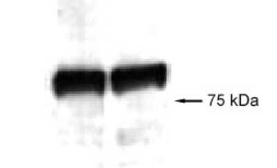 Western Blot: VG5Q Antibody [NB100-455] - Murine VG5Q detected in mouse skin protein extracts.