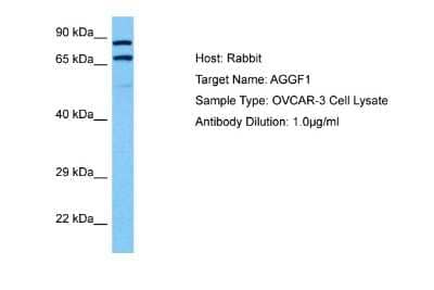 Western Blot: VG5Q Antibody [NBP2-82380] - Host: Rabbit. Target Name: AGGF1. Sample Tissue: Human OVCAR-3 Whole Cell lysates. Antibody Dilution: 1ug/ml