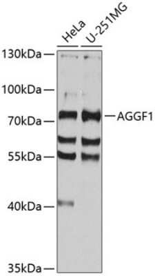 Western Blot: VG5Q Antibody [NBP3-03503] - Analysis of extracts of various cell lines, using VG5Q antibody at 1:1000 dilution. Secondary antibody: HRP Goat Anti-Rabbit IgG (H+L) at 1:10000 dilution. Lysates/proteins: 25ug per lane. Blocking buffer: 3% nonfat dry milk in TBST. Detection: ECL Basic Kit.