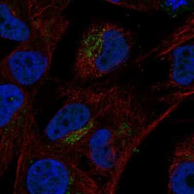 Immunocytochemistry/Immunofluorescence: VGF Antibody [NBP2-31596] - Staining of human cell line SK-MEL-30 shows localization to the Golgi apparatus. Antibody staining is shown in green.