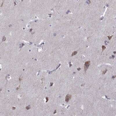 Immunohistochemistry-Paraffin VGF Antibody