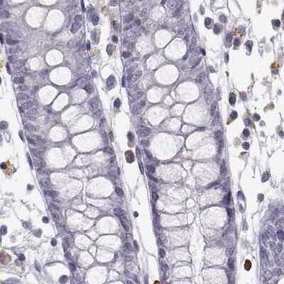 Immunohistochemistry-Paraffin: VGF Antibody [NBP2-31596] - Staining of human colon.