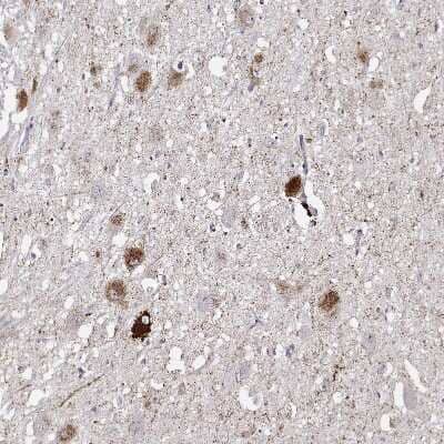 Immunohistochemistry-Paraffin: VGF Antibody [NBP2-31596] - Staining of human hypothalamus shows strong positivity in a subset of neurons.