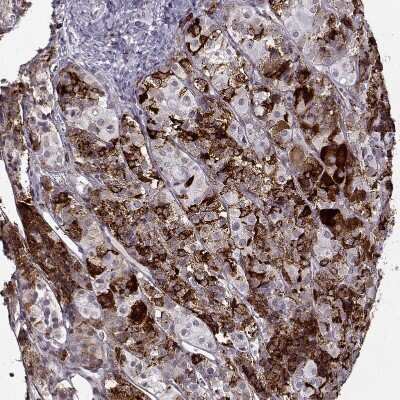 Immunohistochemistry-Paraffin: VGF Antibody [NBP2-31596] - Staining of human pituitary gland shows strong positivity  in anterior cells.