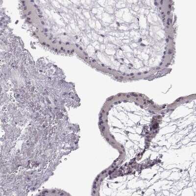 Immunohistochemistry-Paraffin: VGF Antibody [NBP2-31596] - Staining of human placenta shows no positivity in trophoblastic cells as expected.