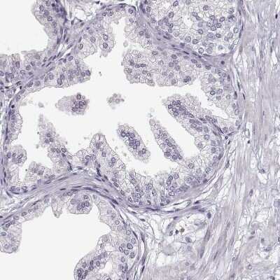 Immunohistochemistry-Paraffin: VGF Antibody [NBP2-31596] - Staining of human prostate shows no positivity in glandular cells as expected.