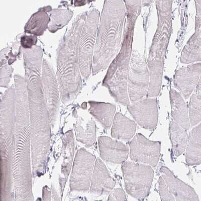 Immunohistochemistry-Paraffin VGLL1 Antibody - BSA Free