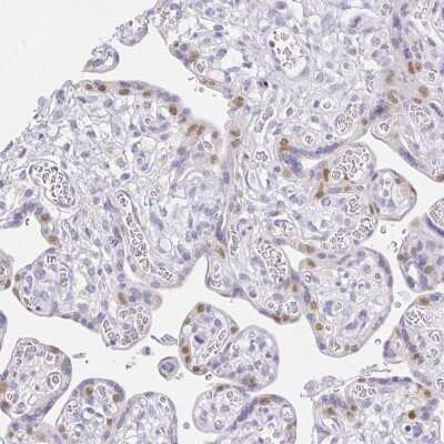 Immunohistochemistry-Paraffin: VGLL1 Antibody [NBP2-31921] - Staining of human placenta shows weak to moderate nuclear positivity in trophoblastic cells.