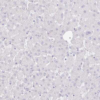 Immunohistochemistry-Paraffin VGLL1 Antibody - BSA Free