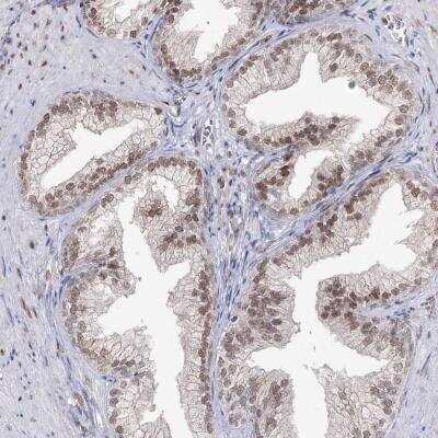 Immunohistochemistry-Paraffin: VGLL4 Antibody [NBP2-38421] - Staining of human prostate shows moderate nuclear positivity in glandular cells.