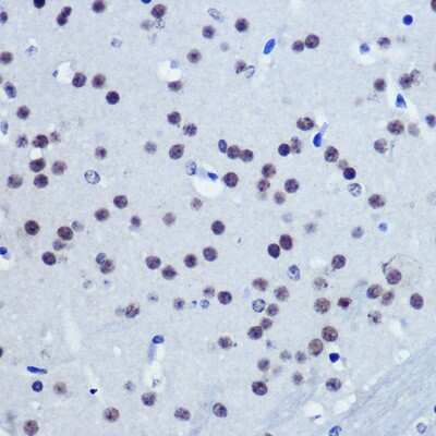 Immunohistochemistry-Paraffin: VGLL4 Antibody [NBP2-93539] - Immunohistochemistry of paraffin-embedded Mouse brain using VGLL4 Rabbit pAb (NBP2-93539) at dilution of 1:100 (40x lens). Perform microwave antigen retrieval with 10 mM Tris/EDTA buffer pH 9.0 before commencing with IHC staining protocol.