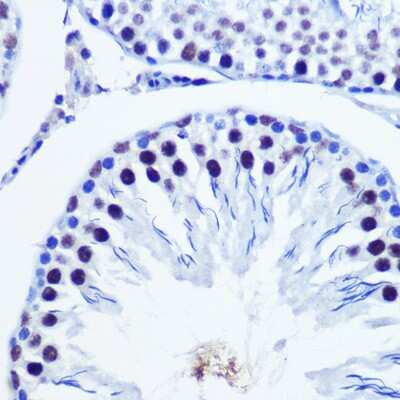 Immunohistochemistry-Paraffin: VGLL4 Antibody [NBP2-93539] - Immunohistochemistry of paraffin-embedded Rat testis using VGLL4 Rabbit pAb (NBP2-93539) at dilution of 1:100 (40x lens). Perform microwave antigen retrieval with 10 mM Tris/EDTA buffer pH 9.0 before commencing with IHC staining protocol.
