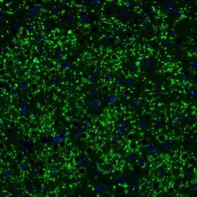 Immunohistochemistry: VGLUT2 Antibody (2921) [NBP2-46640] - Staining of mouse brain shows strong positivity in glutamatergic fibers in the thalamus.