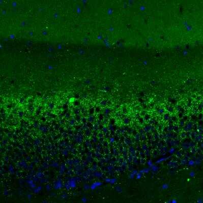 Immunohistochemistry: VGLUT2 Antibody (2921) [NBP2-46640] - Staining of rat hippocampus shows moderate positivity in glutamatergic fibers in granular cell layer of the dentate gyrus.