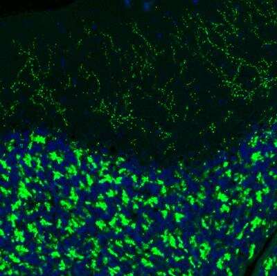 Immunohistochemistry: VGLUT2 Antibody (2921) [NBP2-46640] - Staining of rat brain shows moderate to strong positivity in glutamatergic fibers in the cerebellum.