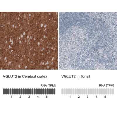 Immunohistochemistry-Paraffin: VGLUT2 Antibody (CL2921) [NBP2-46640] - VGLUT2 Antibody (2921) [NBP2-46640] - Staining in human cerebral cortex and tonsil tissues. Corresponding VGLUT2 RNA-seq data are presented for the same tissues.