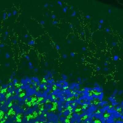 Immunohistochemistry: VGLUT2 Antibody (CL2952) [NBP2-46641] - VGLUT2 Antibody (2952) [NBP2-46641] - Staining of rat cerebellum shows strong immunoreactivity in glutamatergic fibers in the molecular and granular layers.