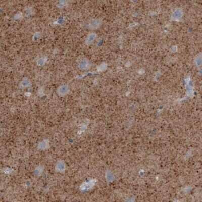 Immunohistochemistry-Paraffin: VGLUT2 Antibody (CL2952) [NBP2-46641] - Staining of human cerebral cortex shows moderate immunoreactivity in neuropil.